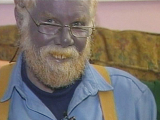 Blue Man Fraud Blue Man Fraud